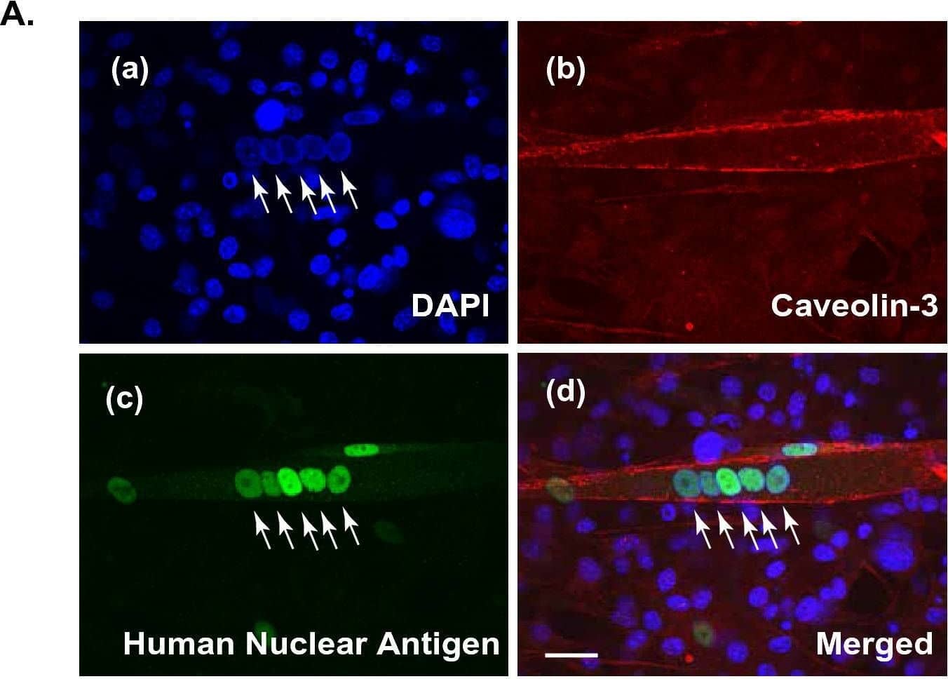 Detection of Myosin Heavy Chain by Immunohistochemistry