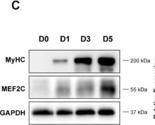 Detection of Myosin Heavy Chain by Western Blot