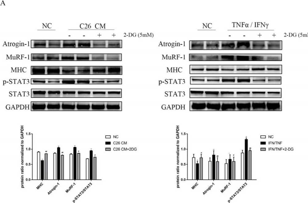 Detection of Myosin Heavy Chain by Western Blot