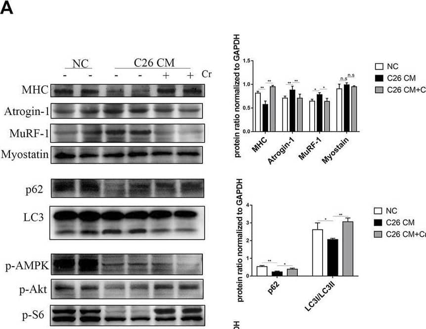 Detection of Myosin Heavy Chain by Western Blot