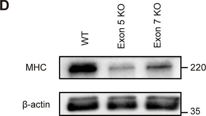 Detection of Myosin Heavy Chain by Western Blot