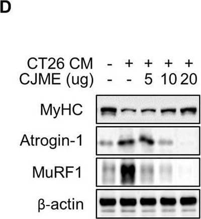 Detection of Myosin Heavy Chain by Western Blot