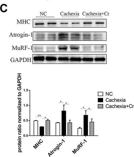 Detection of Myosin Heavy Chain by Western Blot