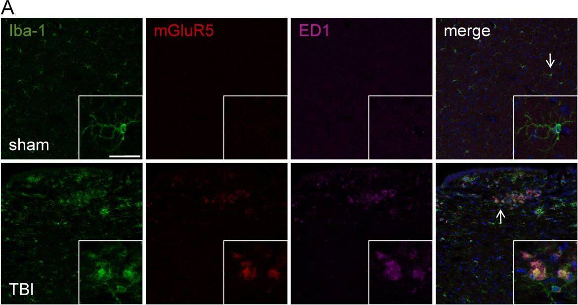 Detection of Mouse mGluR5 by Immunocytochemistry/Immunofluorescence