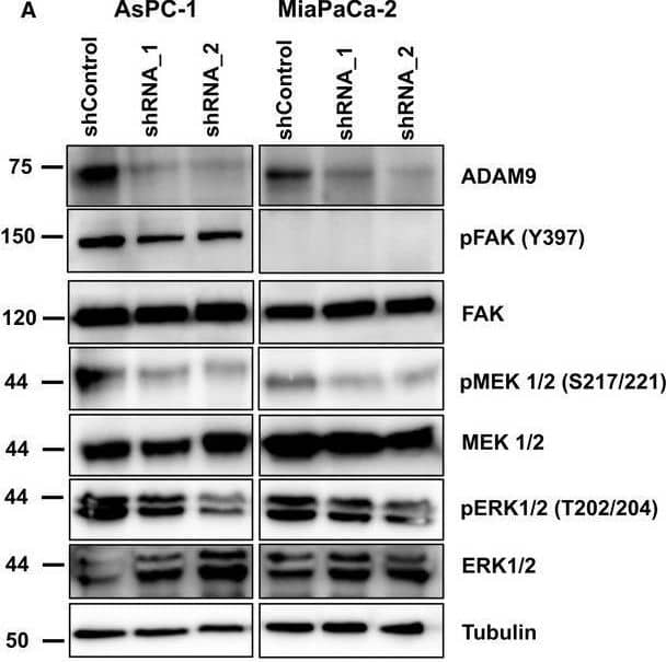 Detection of Human Phospho-FAK (Y397) by Western Blot
