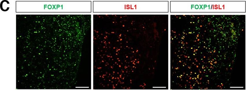 Detection of Human FoxP1 by Immunocytochemistry/Immunofluorescence