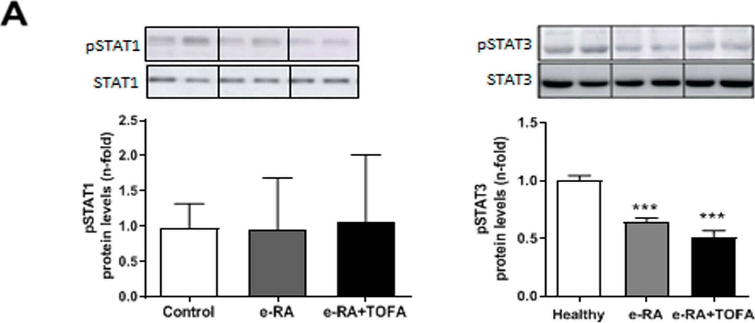 Detection of Phospho-STAT3 (Y705) by Western Blot