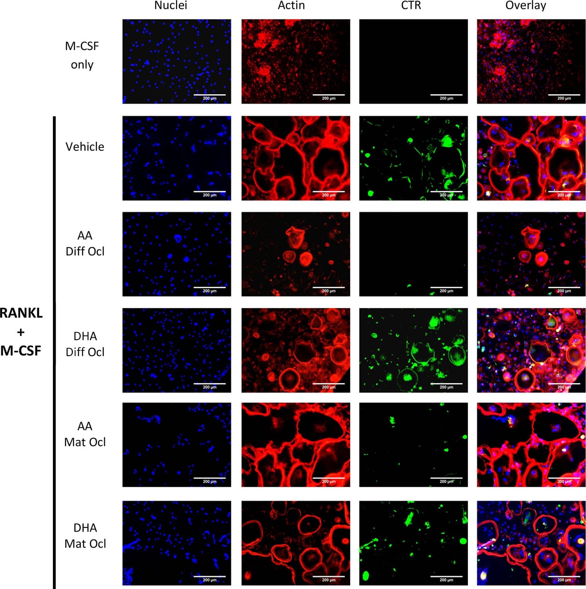 Detection of Human Calcitonin R by Immunocytochemistry/Immunofluorescence
