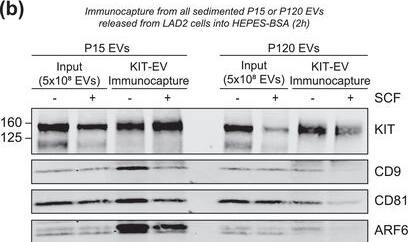 Detection of Human CD81 by Western Blot