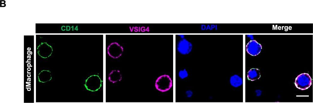 Detection of Human VSIG4 by Immunocytochemistry/ Immunofluorescence