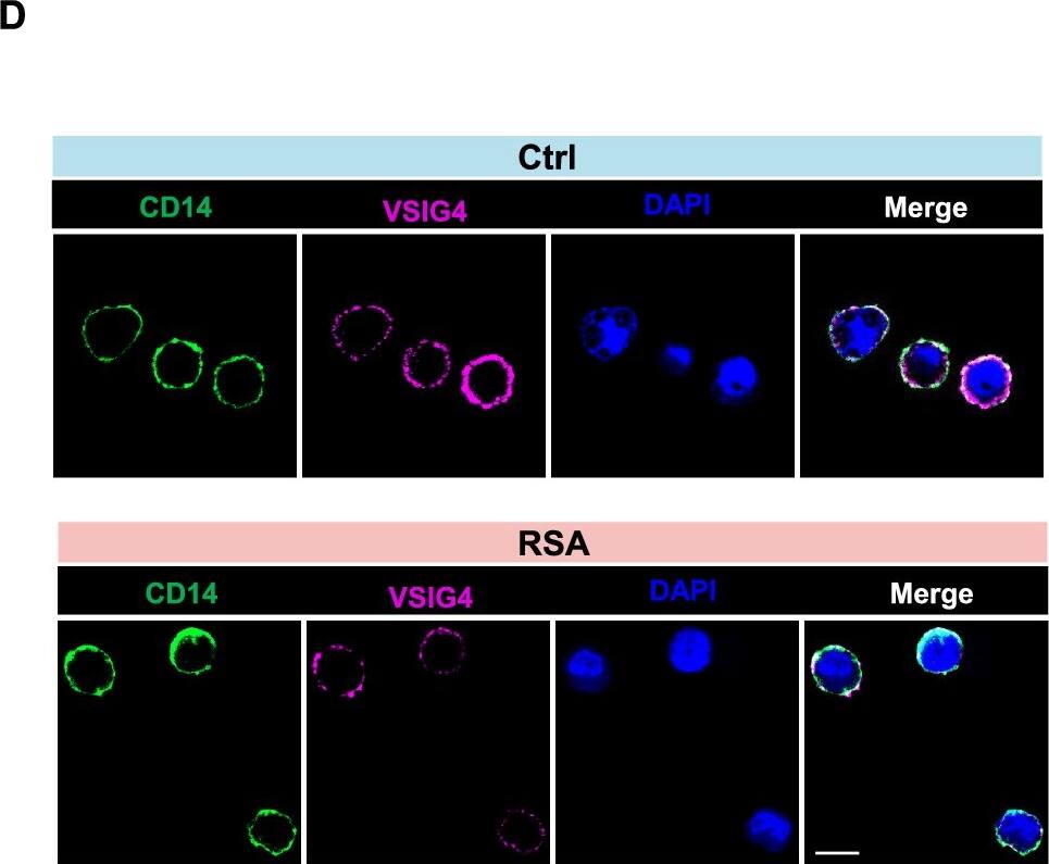 Detection of Human VSIG4 by Immunocytochemistry/ Immunofluorescence