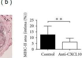 Detection of Mouse CXCL10/IP-10/CRG-2 by Immunohistochemistry