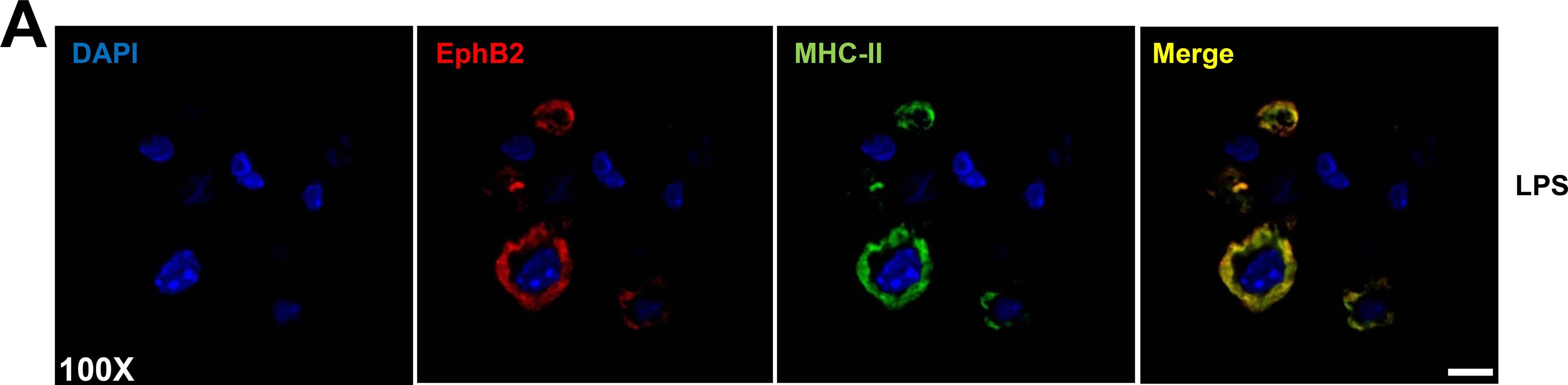 Detection of Mouse EphB2 by Immunocytochemistry/Immunofluorescence