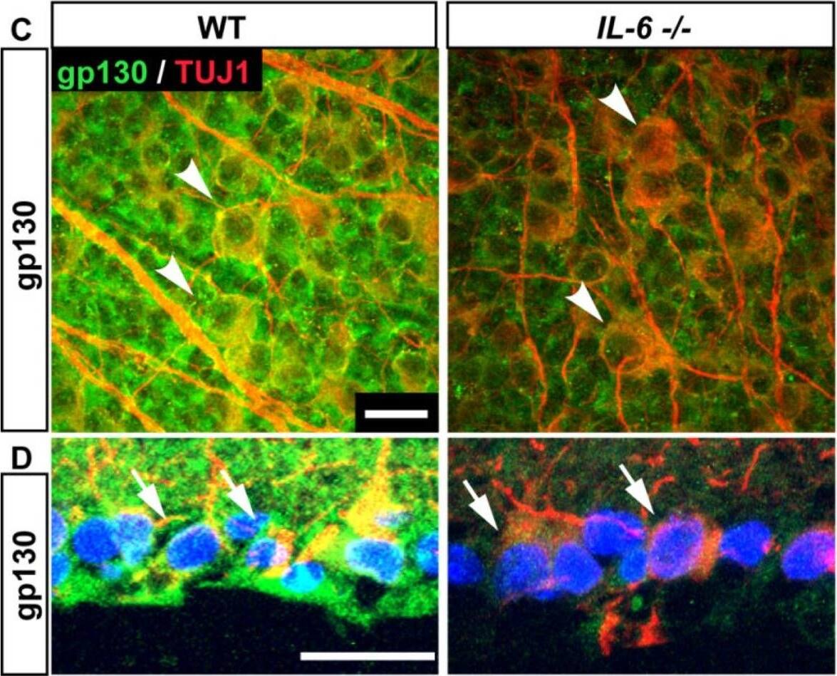 Detection of Mouse gp130/CD130 by Immunohistochemistry