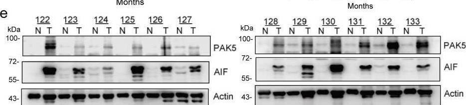 Detection of PAK7 by Western Blot