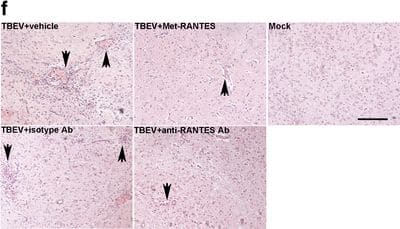 Detection of Mouse CCL5/RANTES by Immunohistochemistry