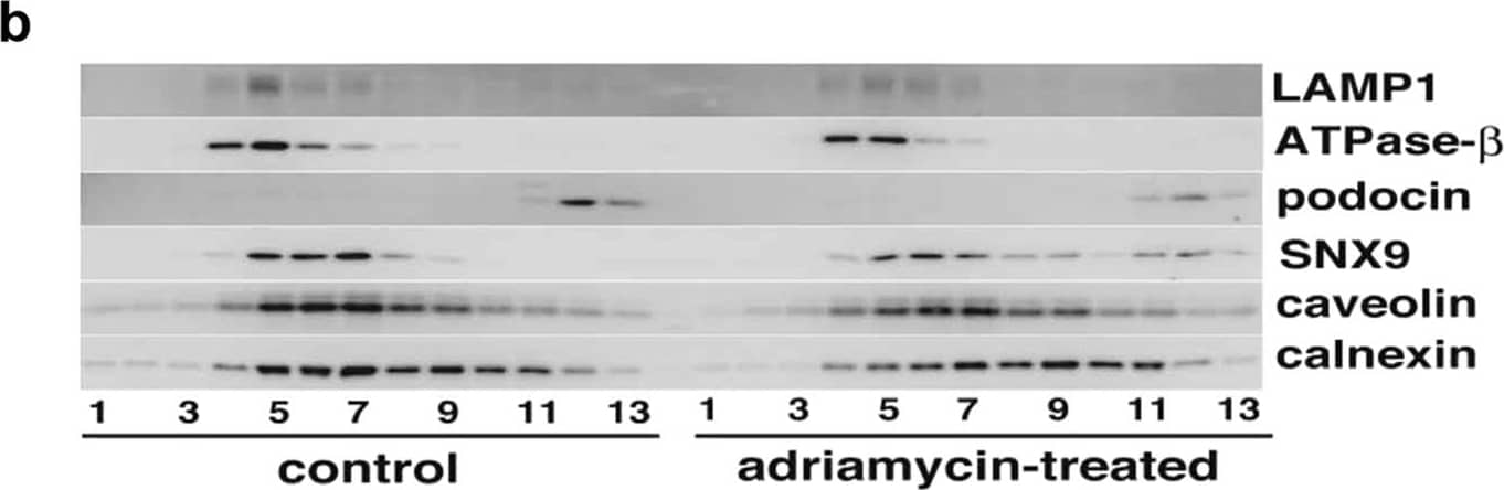 Detection of Human LAMP-1/CD107a by Western Blot
