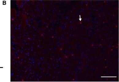 Detection of Mouse CD3 by Immunocytochemistry/Immunofluorescence