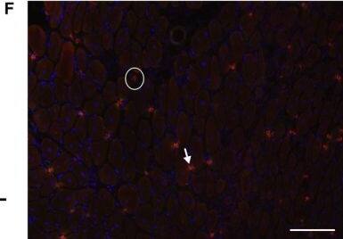 Detection of Mouse CD3 by Immunocytochemistry/Immunofluorescence