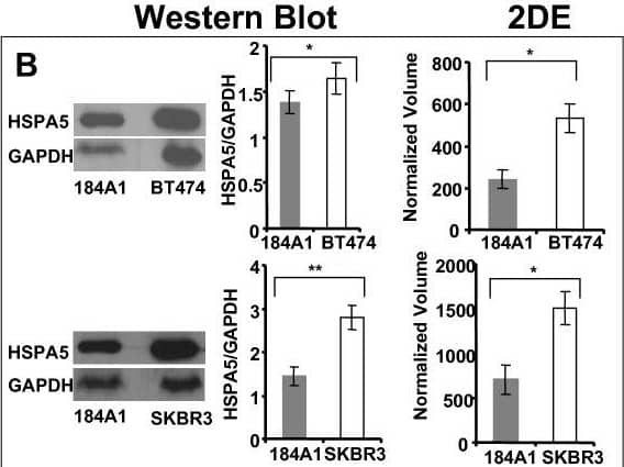 Detection of GRP78/HSPA5 by Western Blot