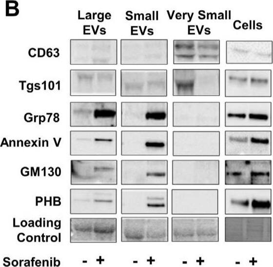 Detection of GRP78/HSPA5 by Western Blot