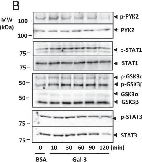 Detection of Phospho-STAT3 (S727) by Western Blot