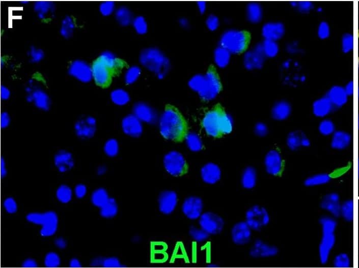 Detection of Human BAI1 by Immunohistochemistry