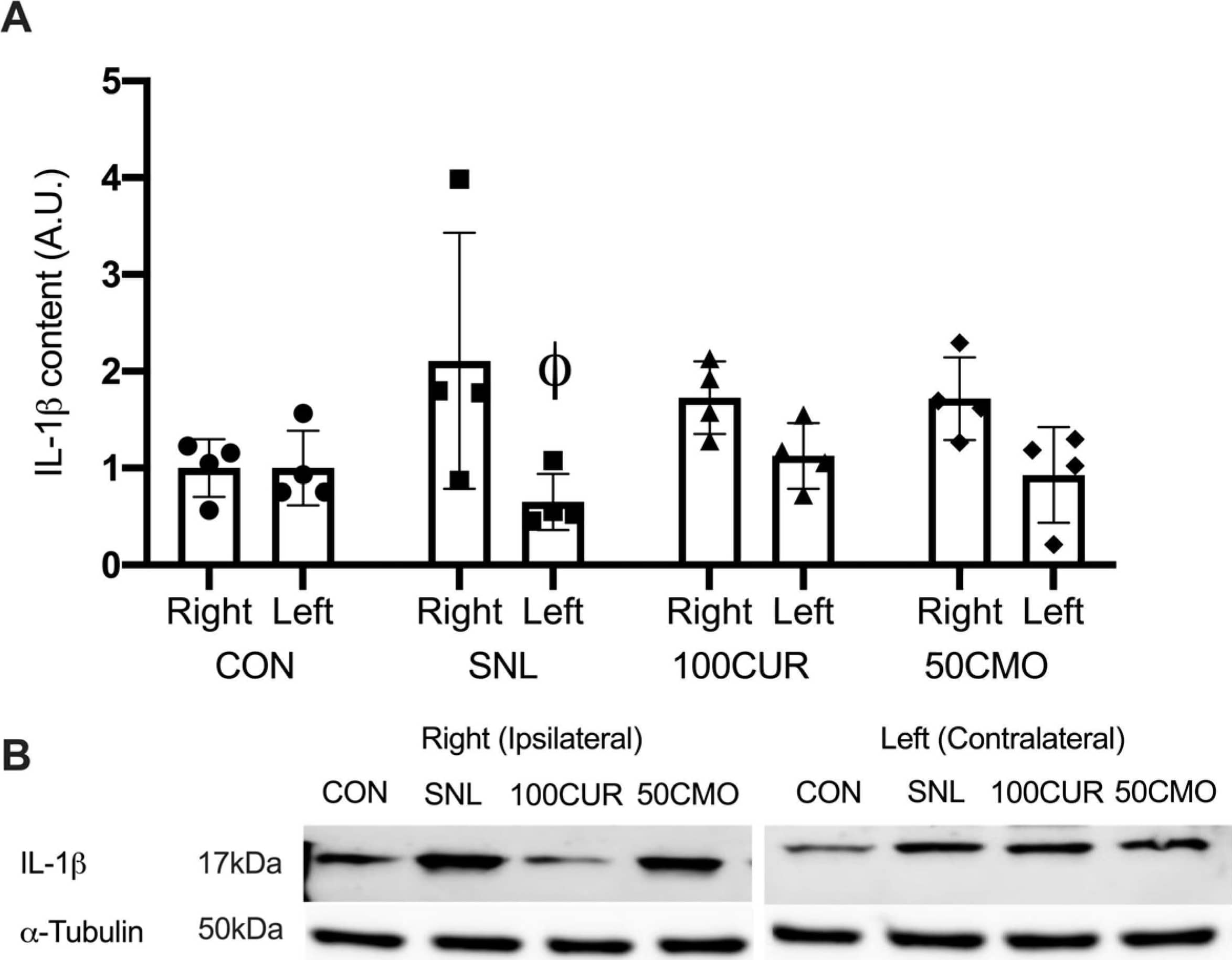 Detection of Rat IL-1 beta/IL-1F2 by Western Blot