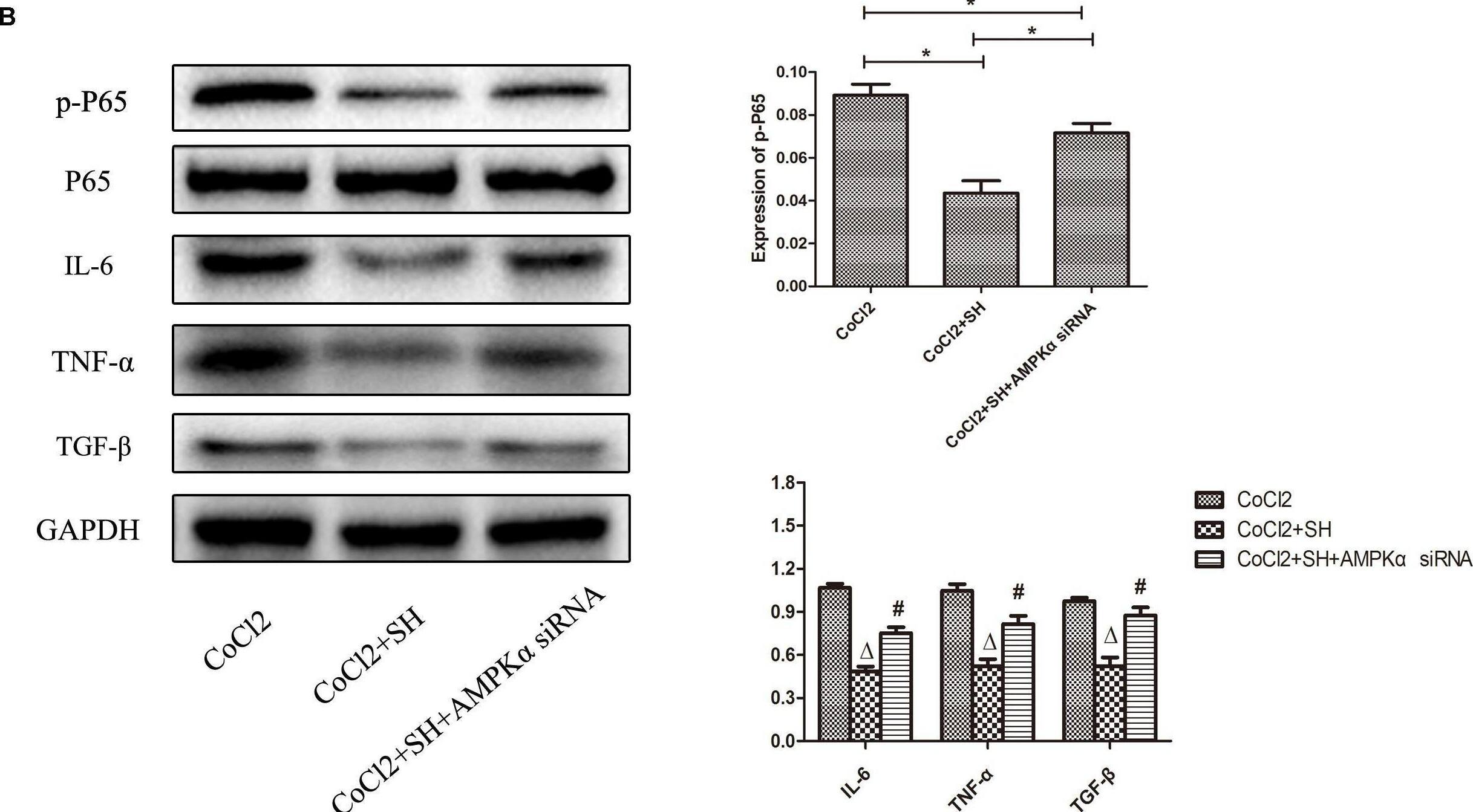 Detection of IL-6 by Western Blot