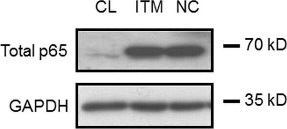 Detection of Human RelA/NFkB p65 by Western Blot