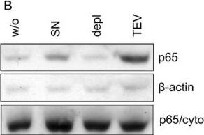 Detection of Human RelA/NFkB p65 by Western Blot
