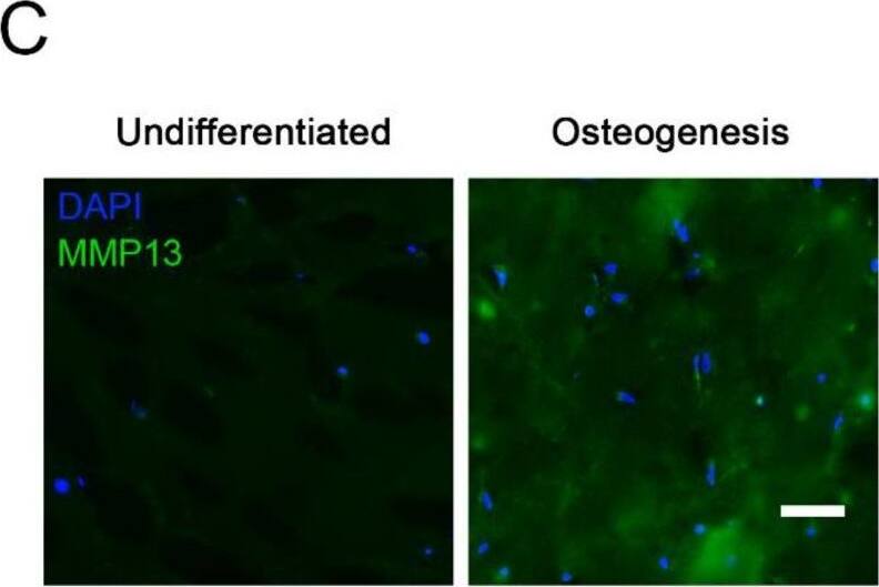 Detection of Human MMP-13 by Immunohistochemistry