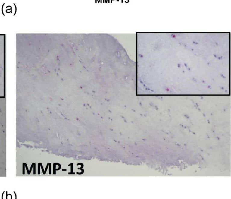 Detection of MMP-13 by Immunohistochemistry