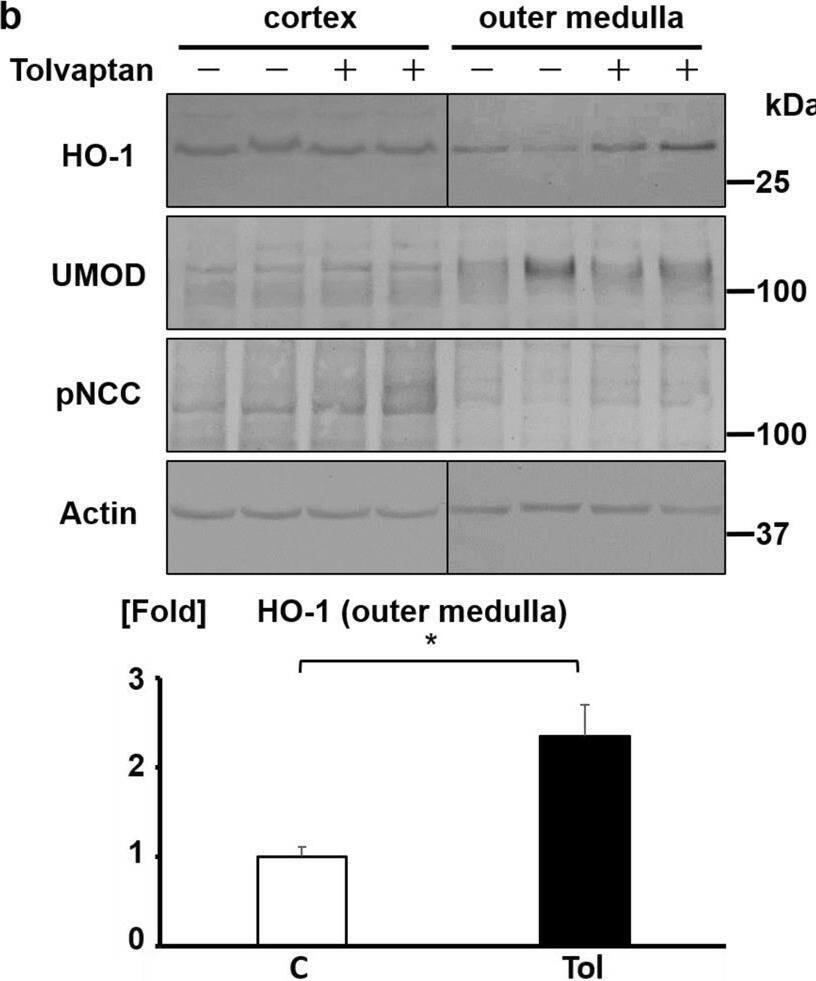 Detection of Uromodulin by Western Blot
