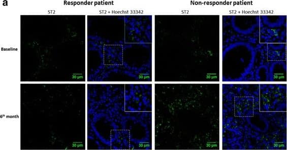 Detection of Human ST2/IL-33R by Immunocytochemistry/Immunofluorescence