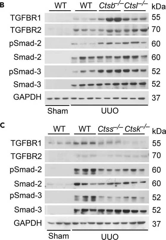 Detection of Mouse TGF-beta RII by Western Blot