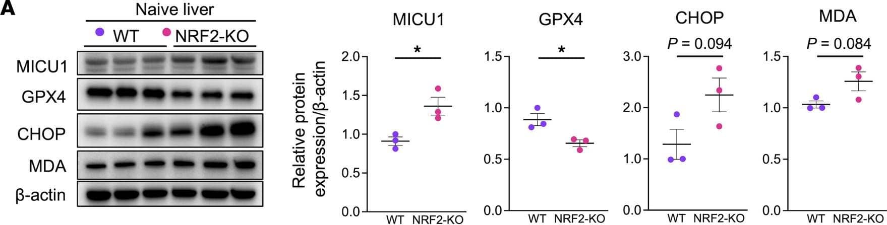 Detection of Glutathione Peroxidase 4/GPX4 by Western Blot
