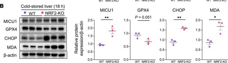 Detection of Glutathione Peroxidase 4/GPX4 by Western Blot