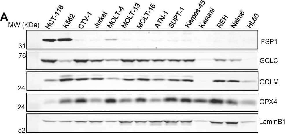 Detection of Glutathione Peroxidase 4/GPX4 by Western Blot