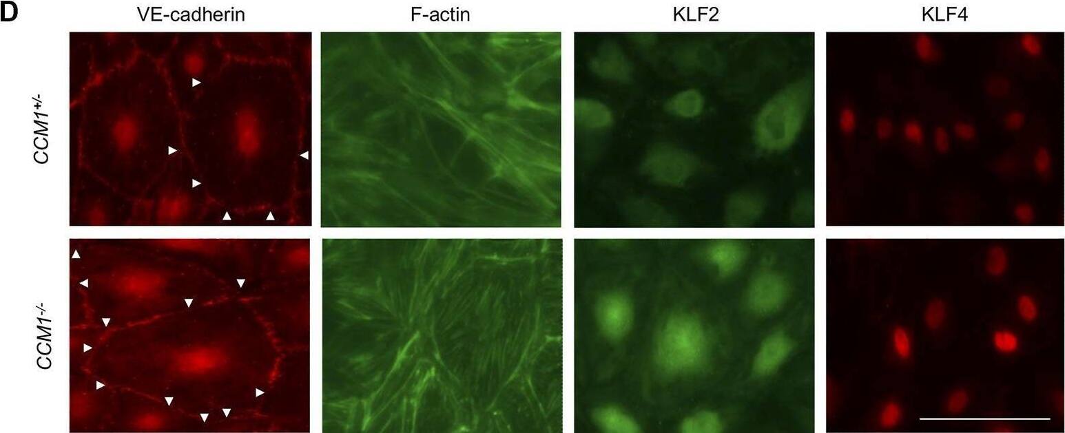 Detection of Human KLF2 by Immunocytochemistry/ Immunofluorescence