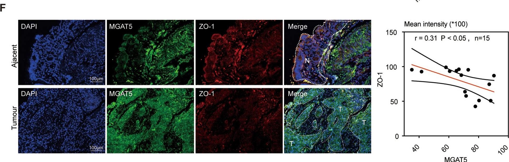 Detection of Human N-Acetylglucosaminyltransferase V/MGAT5 by Immunohistochemistry