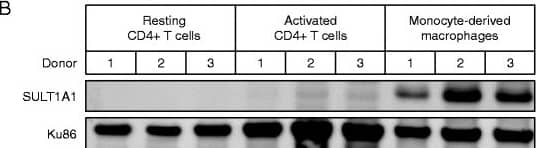 Detection of Cytosolic Sulfotransferase 1A1/SULT1A1 by Western Blot