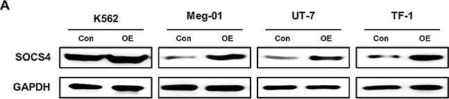 Detection of SOCS-4 by Western Blot