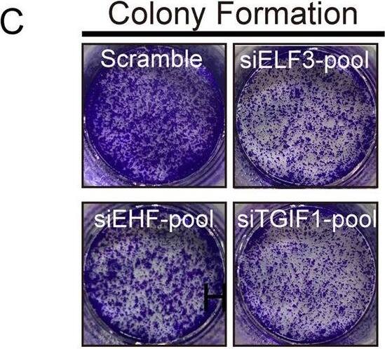 Detection of Human ELF3/ESE-1 by Immunohistochemistry