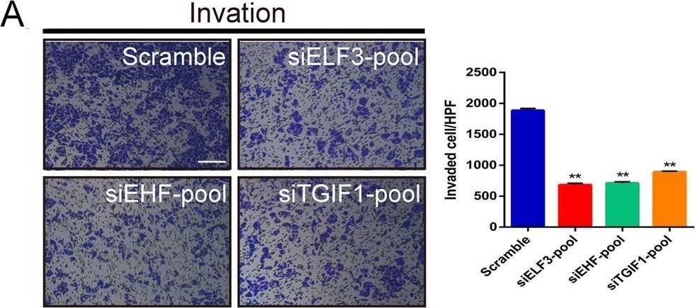 Detection of Human ELF3/ESE-1 by Immunohistochemistry