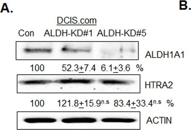 Detection of Human Aldehyde Dehydrogenase 1-A1/ALDH1A1 by Western Blot