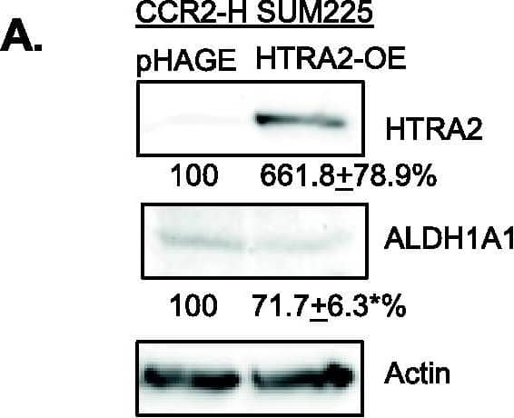 Detection of Human Aldehyde Dehydrogenase 1-A1/ALDH1A1 by Western Blot