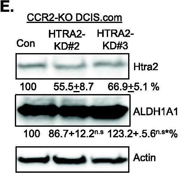 Detection of Human Aldehyde Dehydrogenase 1-A1/ALDH1A1 by Western Blot