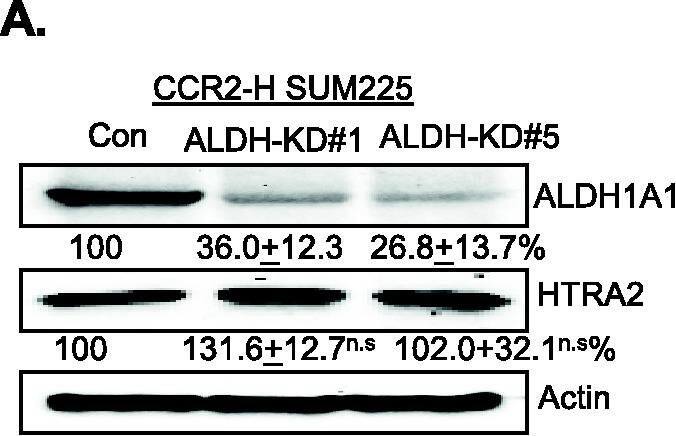 Detection of Human Aldehyde Dehydrogenase 1-A1/ALDH1A1 by Western Blot