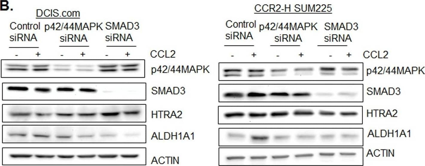 Detection of Human Aldehyde Dehydrogenase 1-A1/ALDH1A1 by Western Blot
